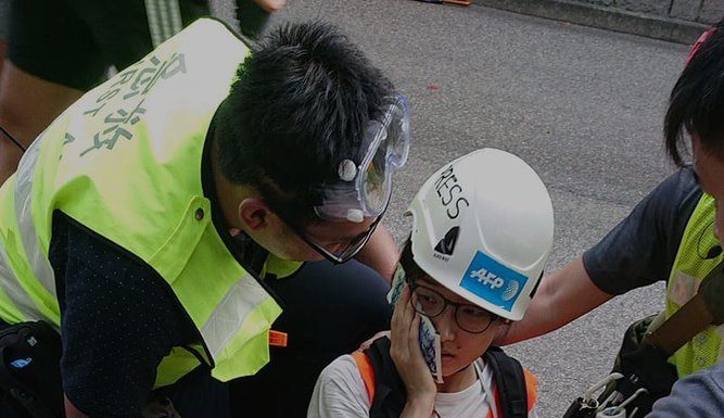 HK-妮珂:法新社一位女记者被香港警察打伤
