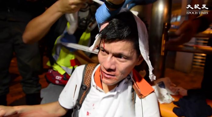 【直擊728港警開槍】警察對民眾狂射過百枚催淚彈 多名示威者受傷血流遍地