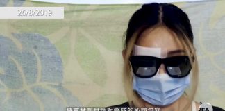香港爆眼少女亮相发声,要求港警停止暴力对待市民