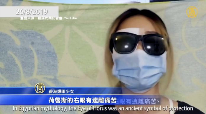 香港爆眼少女18天后首度发声:盼我右眼有如埃及神话的力量令其战胜邪恶